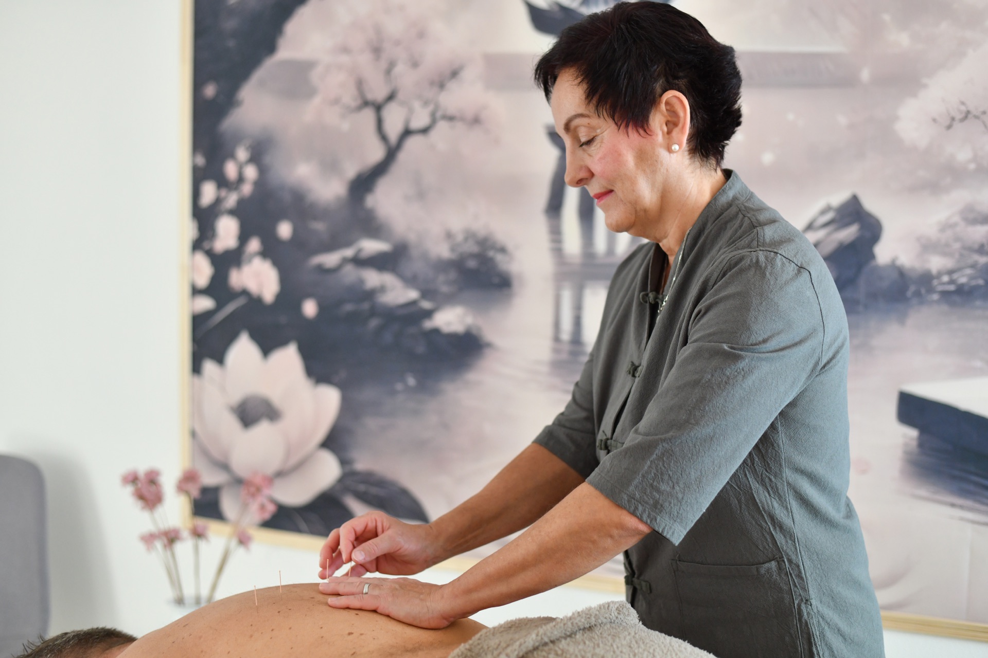 Akupunktúra - aplikácia ihličiek