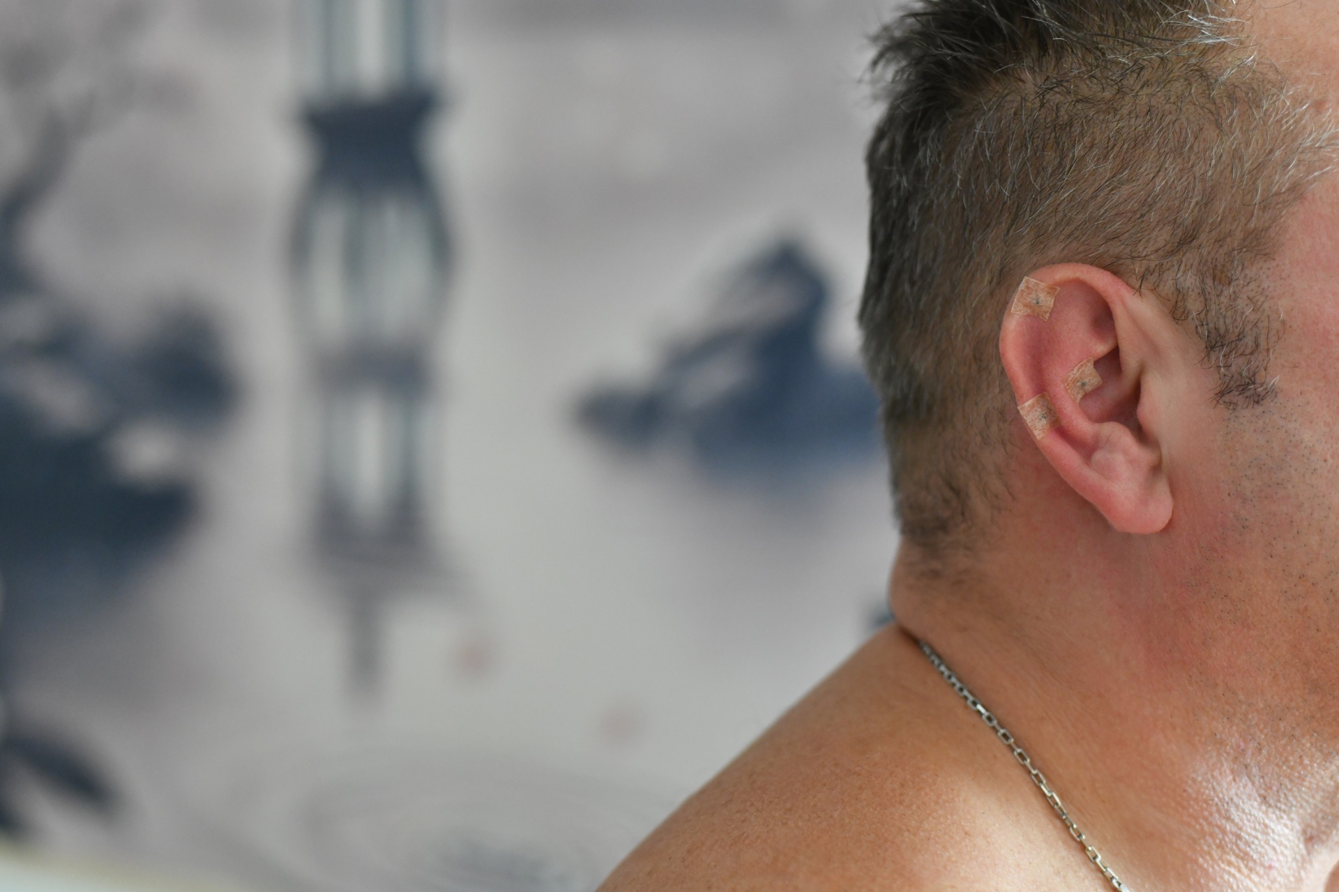 Aurikuloterapia - ucho